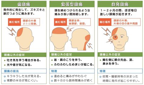 頭痛|頭痛の原因は？症状や発生状況から知る頭痛のタイプ。